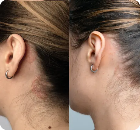 before after results